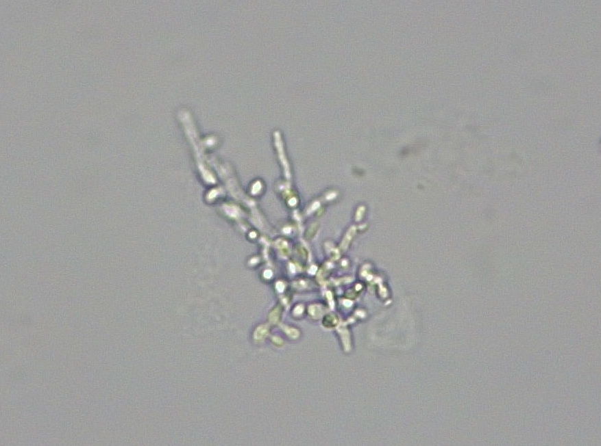 Urine Yeast